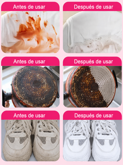 🎁【Nueva fórmula japonesa】Quitamanchas universal para ropa blanca y manchas difíciles ✅️Pago contra entrega
