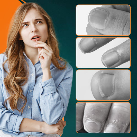 💅 Kupite 1, dobite 1 gratis! ✨ Avtomatska pilica za nohte za vsakodnevno uporabo, nežno in varno neguje vaše nohte 👶🔧